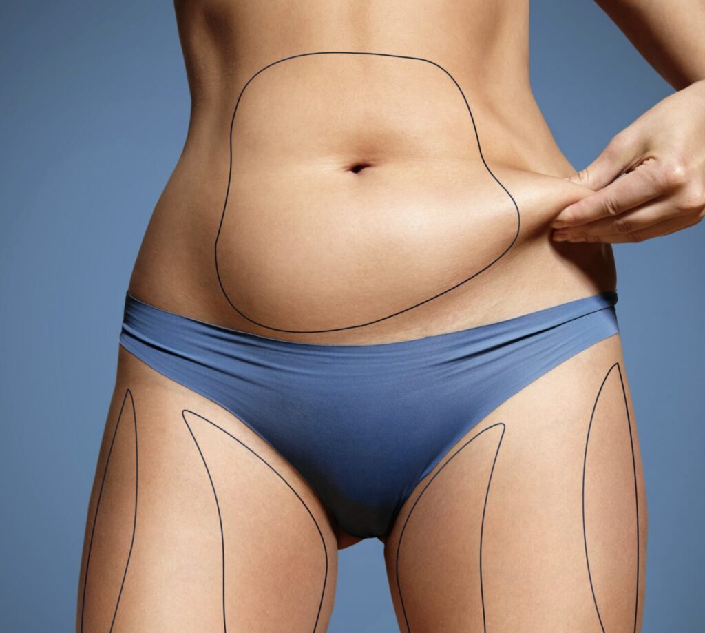 Body Contouring Brisbane